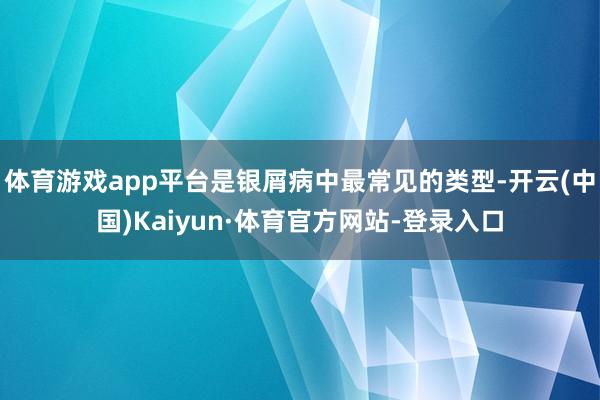 体育游戏app平台是银屑病中最常见的类型-开云(中国)Kaiyun·体育官方网站-登录入口